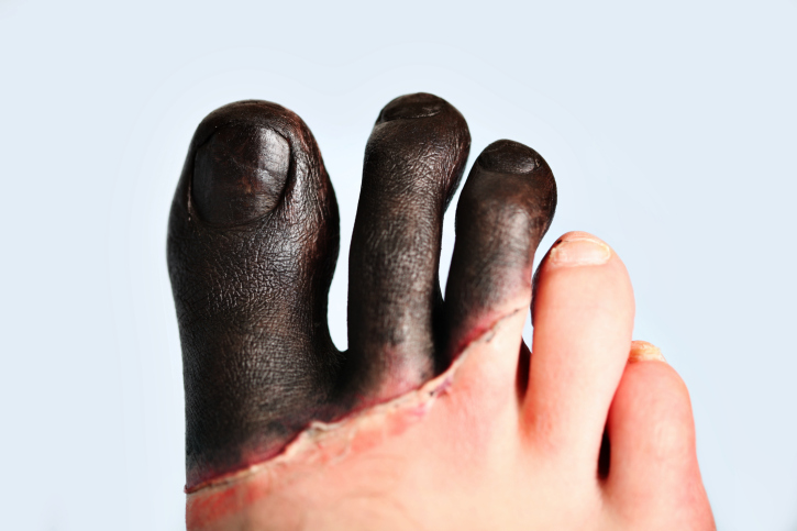 ways-to-prevent-frostbite